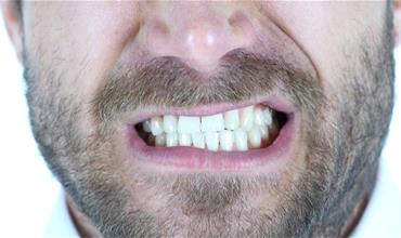 دندان قروچه چیست، علت و  روش درمان آن